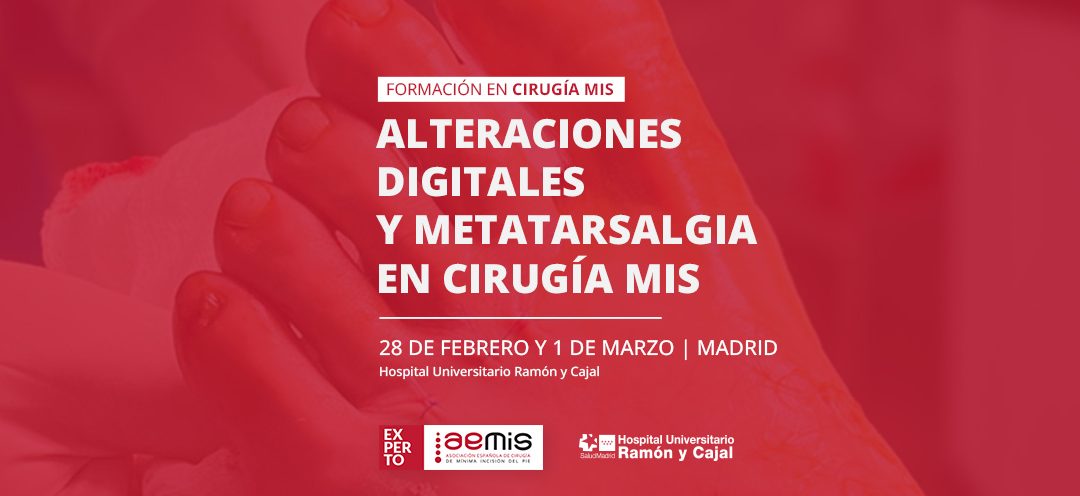 Alteraciones digitales y metatarsalgia con cirugía MIS