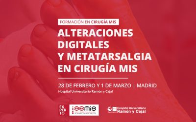 Alteraciones digitales y metatarsalgia con cirugía MIS