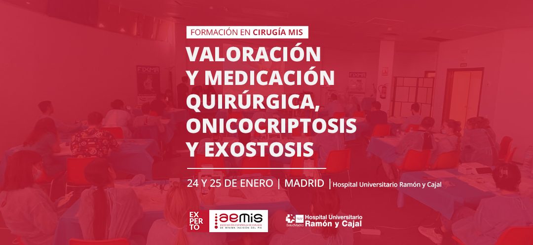 Valoración y medicación quirúrgica. onicocriptosis y exostosis